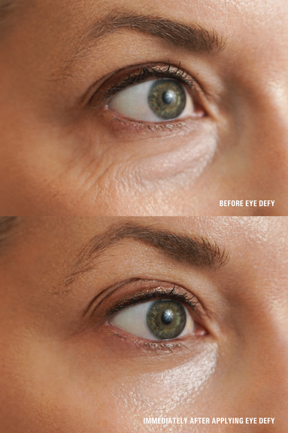 Eye Defy - Reskined- Best Price in United States