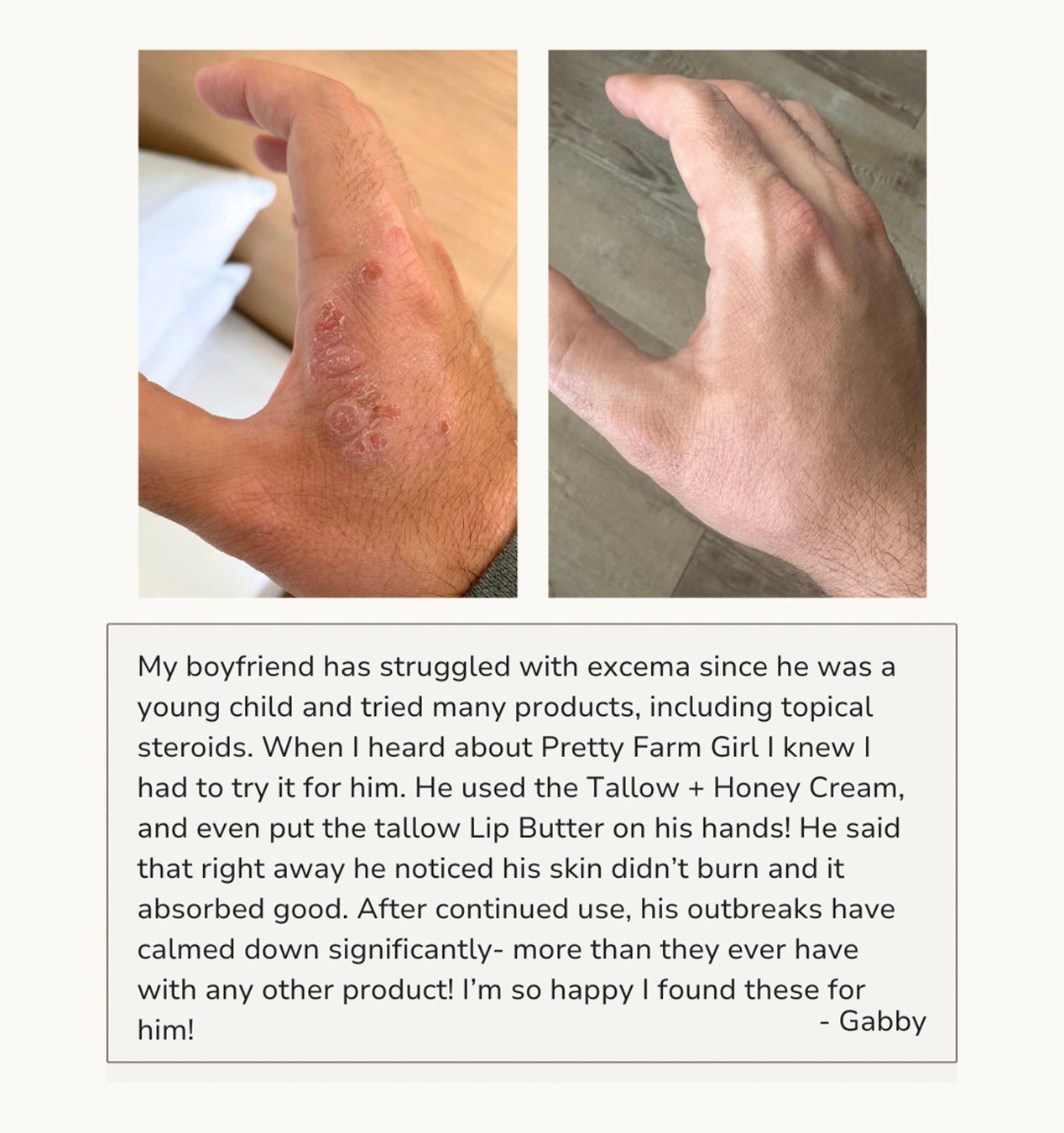 Fragrance Free Tallow + Honey Cream for Sensitive Skin - Reskined- Best Price in United States
