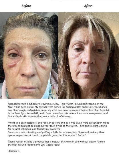 Pure + Simple Skin Kit for Sensitive Skin - Reskined- Best Price in United States