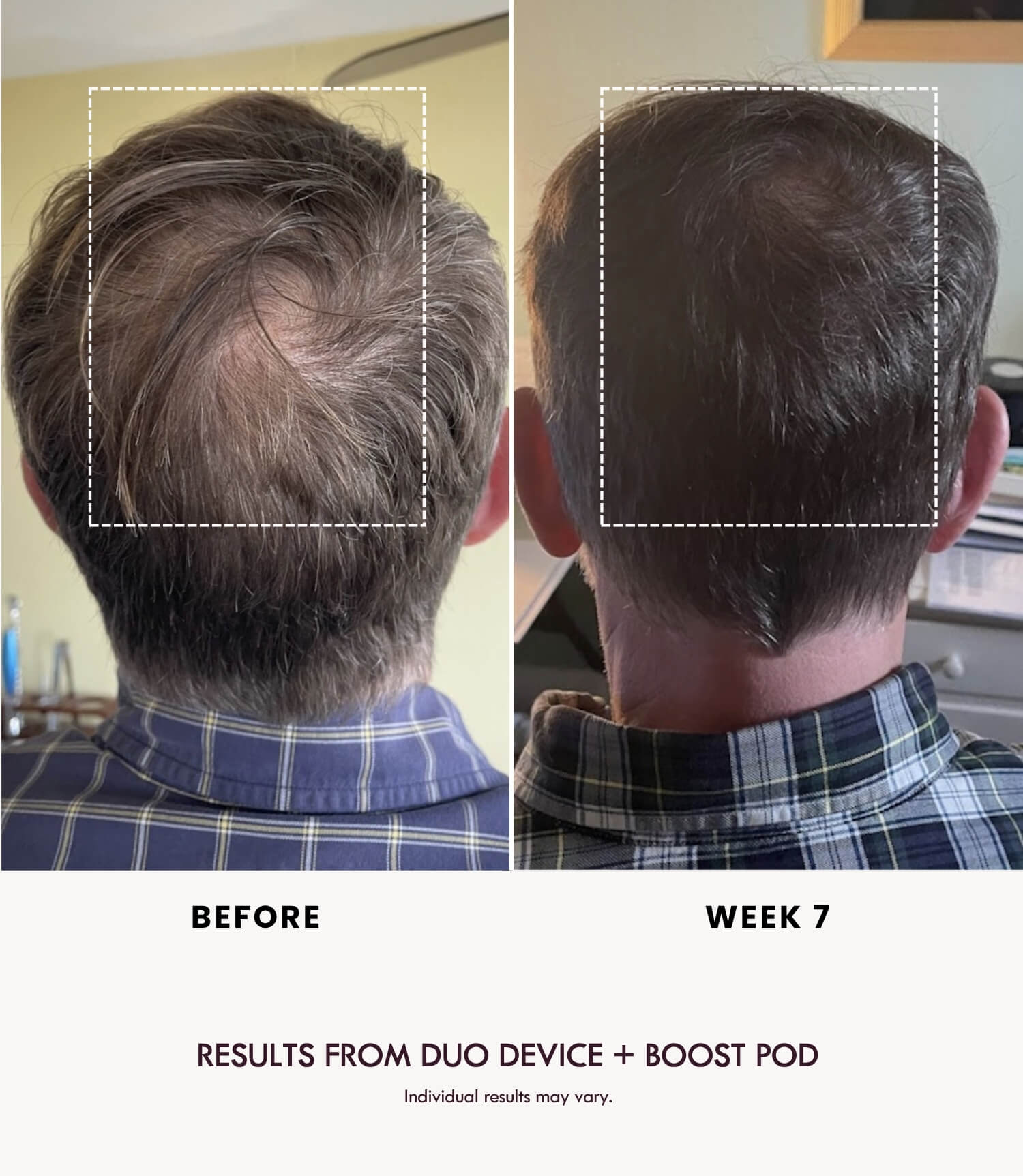 BOOST DUO POD - Reskined- Best Price in United States