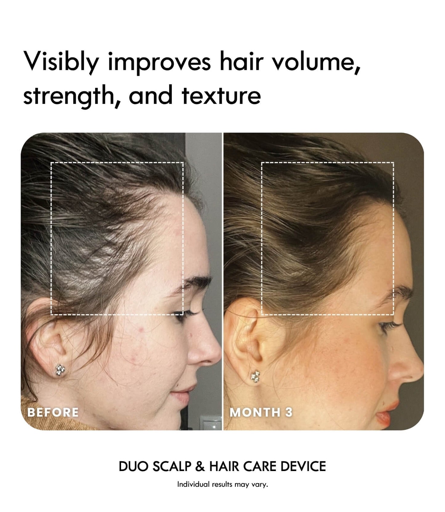 Laduora DUO 4-in-1 Pod Based Scalp & Hair Care Device - Reskined- Best Price in United States