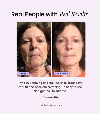 Velve Pro 5-in-1 Skincare Wand - Reskined- Best Price in United States