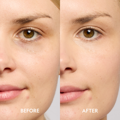 Super Bright Dark Circle Serum Peptide Corrector - Reskined- Best Price in United States