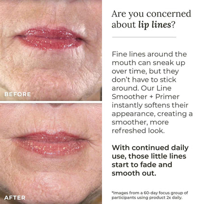 Line Smoother + Primer with Neodermyl®